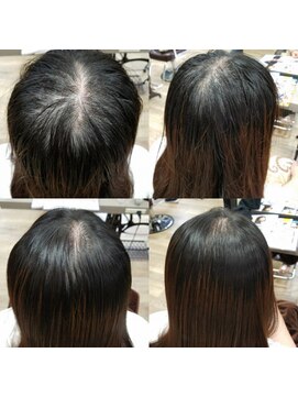 ルーミールーム(RoomieRoom) お悩み解決☆頭皮改善育毛を促すケア