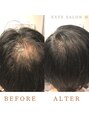 エクステサロンエム(EXTE SALON M) 頭頂部の透け感カバー！つむじの透け感割れ目で悩まれている方！
