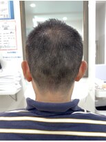シルク(Silk)&nbsp;4ミリからのすっきりナチュラルスタイル！