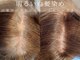 ホワイト テラス(White Terrace)の写真