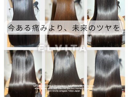 エルヴィタ(ELVITA)の写真