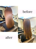 アールサロンプラスキャスパ 自由が丘(Rrsalon+CASPA)&nbsp;【最新】R.HAS XE(エクソソーム)人幹細胞水素トリートメント