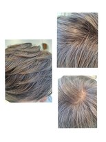 ユーフォルムギンザ(y-Forme Ginza)&nbsp;カラーエステ/白髪ぼかしカラー♪