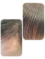 ユーフォルムギンザ(y-Forme Ginza)&nbsp;話題のトキカタ♪前髪編