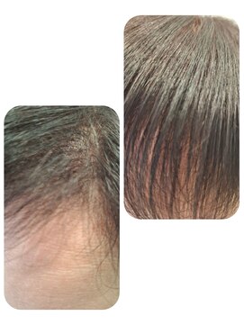 ユーフォルムギンザ(y-Forme Ginza) 話題のトキカタ♪前髪編