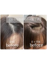 アンジュール ラナリア(1//jour LanaRia) 【生え癖のお悩みに】ヘアリセッターで驚きの変化!