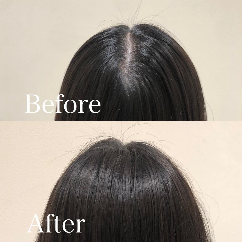 新宿 neolive】韓国発！大人気根元パーマ：L092470032｜オリーブスバイ