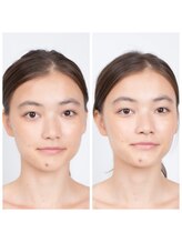 ビフォー&アフター