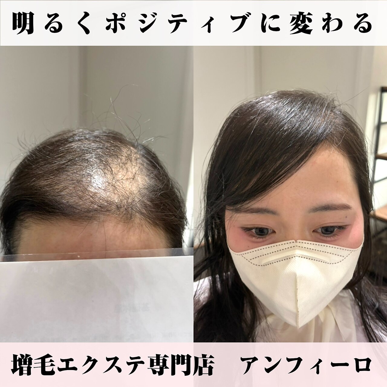 増毛エクステ(ヘアループ)2000本：L028893095｜アンフィーロ(An filo