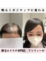アンフィーロ(An filo)&nbsp;増毛エクステ