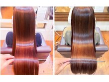 無理な施術はしない