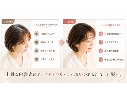 リカレ(Re:care)の写真