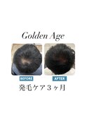 【発 毛 ケ ア 3ヶ月】Before&After