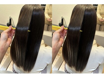 ロメ(Lome)の写真