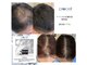 ヘアスペース レフュージエヌ(Hair space Refuge N)の写真