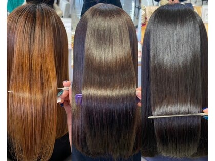 トロシェナ(TOLOCHENAZ)の写真