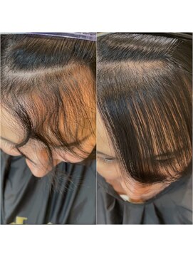 アッシュ 等々力店(Ash) 前髪/顔周り縮毛矯正