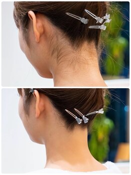 ヘアープレイスクリアライン 栄町店(hair place CLEAR LINE)の写真/【初回限定でお得にうなじ脱毛】キレイを叶えるサロン☆