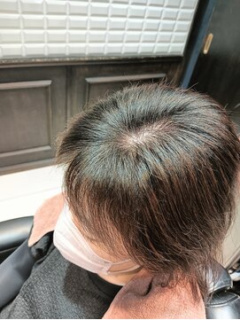 ルピナス(Lupinus) #1 エクソソーム　6回コース　終了後