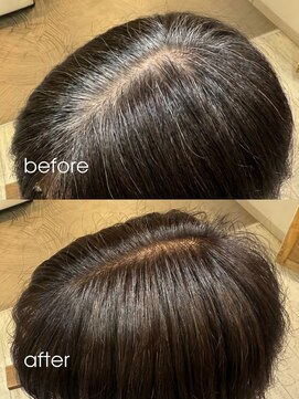 ワンマイル 八潮店(one mile) 30代40代50代◎白髪染めリタッチカラーミディアムヘア八潮