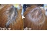 【髪と頭皮を根本からケア】【男性◎女性◎】強髪100％＋ヘッドスパ  ￥11,000