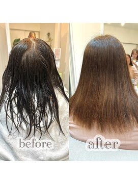 アス(Asu) 骨格矯正ストレート