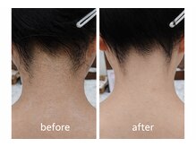 レオ(LEO)の雰囲気（【レディースシェービング】うなじを整えるだけでこの違い！）