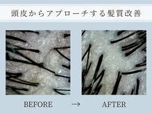 アリエス(Aries)の雰囲気（AI分析マイクロスコープ頭皮診断【ヘッドスパ/麻布十番駅】）