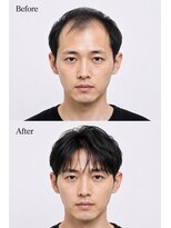 アフィーロ(ACHFILO)&nbsp;メンズエクステ 前髪エクステ エクステ 韓国ヘア 髪質改善 前髪