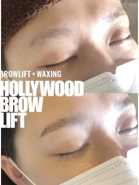 フィーカ(FIKA) 次世代型眉毛ブロウリフト【HBL】