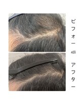 シップス(ships)&nbsp;ヒト幹トリプルショット/育毛促進/頭皮改善