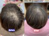 【新大久保】増 毛 エクステ【つむじの分かれ目気になる人向け】600本コース