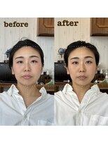 ザラメ(ZARAME)&nbsp;骨格補正スパ+骨格カウンセリング