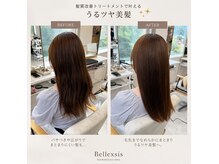 ベルシス(Bellexsis)