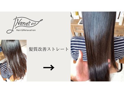 ノネット(Nonet plus)の写真