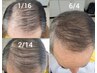 若い頃のような若々しいヘアスタイルを実現する髪を太くするコース￥8800