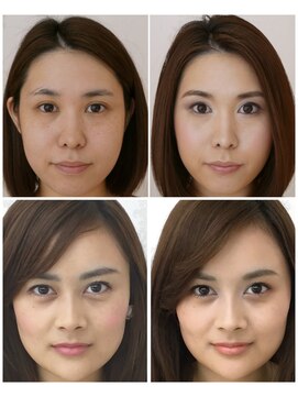 アガール 黄金比メイク ビフォーアフター