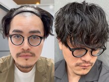 リケア プラス(RECARE Plus+)の雰囲気（専用テープで直接貼り付けられるウィッグ【ツーぺ】3ヶ月利用◎）