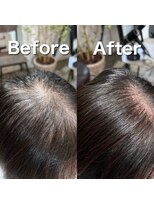 ツムグ 代官山 中目黒(TUMUGU)&nbsp;前髪割れ・地肌見え解消/ボリュームアップエクステ