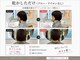 アノン (ANON)の写真
