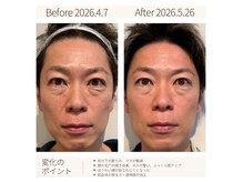 キヌ 銀座(KINU)の雰囲気（貴重な再生因子【至純】W施術40代後半50代お客様から圧倒的支持）