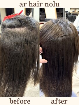 アールヘアノル(ar hair nolu) 髪質改善縮毛矯正 8