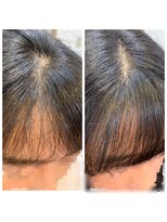 ラッソ ルーツヘアー 明石店(laco Roots Hair)&nbsp;前髪のボリュームエクステ