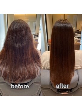 たった1回の施術で生まれ変わる