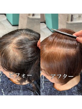 ルアナ トウキョウ(Luana TOKYO) 明るくする白髪染め　リムーバーカラー