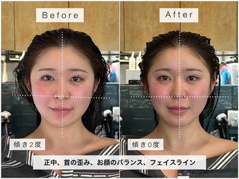 シャウルデッサントウキョウ 表参道(CHARLES DESSIN Tokyo)の写真/今話題の骨格補正で浮腫も取れてすっきり小顔に♪ [表参道/青山/髪質改善/酸性ストレート/ヘッドスパ]