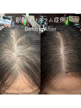 ハーティー(Hearty) トップボリューム改善