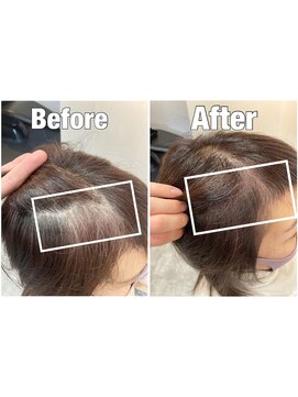 ヒストリア(HISTORIA) 根本カラーリング