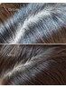 【分け目、ボリュームが気になる方】再生育毛コース