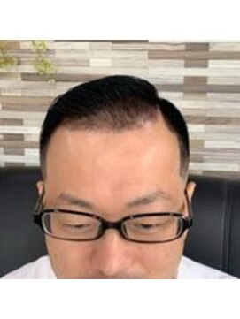 アキヤマ(Akiyama) 白髪染め